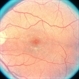 Bull's Eye
